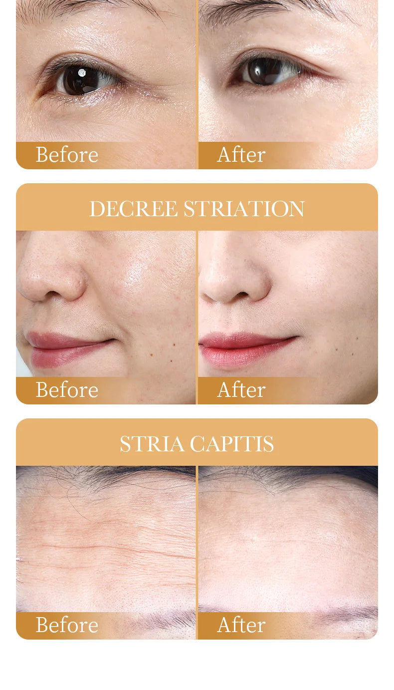 Masque Facial Anti-Rides au Collagène — Pack 10 Pièces